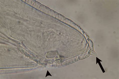 Fig. 4. A boring tooth (arrow) at the anterior end of the worm.