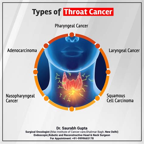 Dr. Saurabh Gupta Oncologist: Types of Throat Cancer