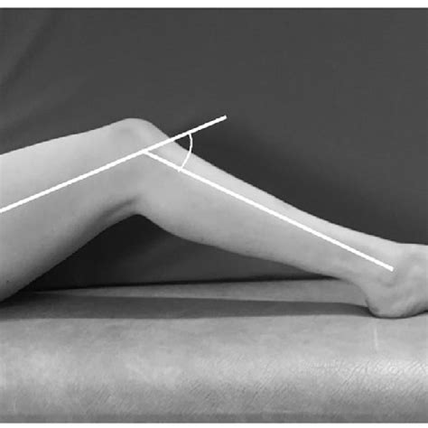 Examination position of knee flexion contracture. By using a goniometer ...