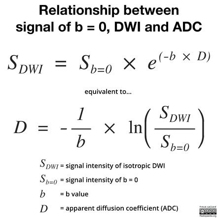 MRI physics (diagrams) | Image | Radiopaedia.org