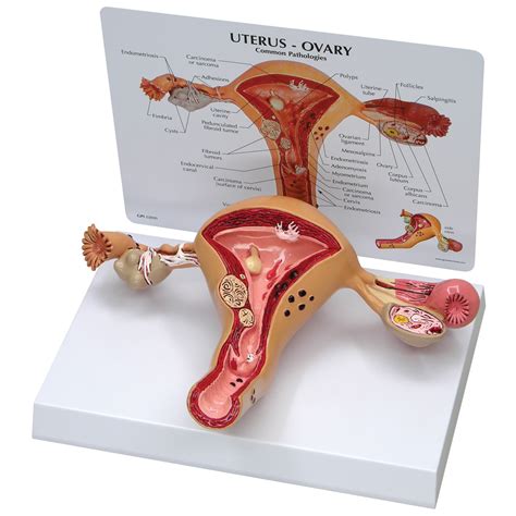 Uterus-Ovary Model - 1019594 - W33352 - 3480 - Genital and Pelvis ...