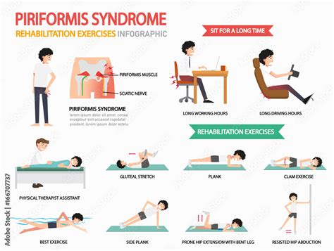 piriformis syndrome rehabilitation exercises infographic, illustration ...