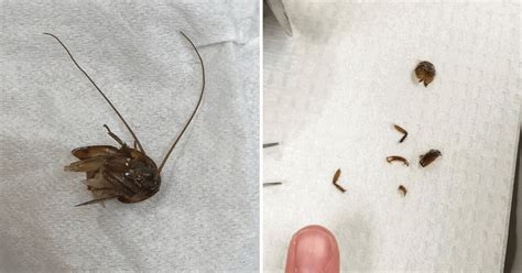 Cockroach In Ear Story: What To Do If Insect Crawls Into Child's Ear?