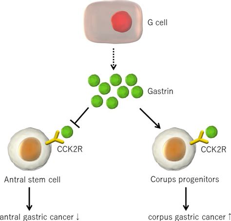 Gastrin’s effects on the development of stomach cancer. Gastrin ...