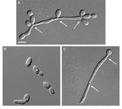 Confundir Posibilidades Sermón candida budding yeast Haz un esfuerzo ...