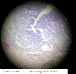 Histology Slides Database: Appendix histology slide (vermiform appendix slide)