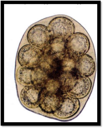 ANTII- Endoparasites III Flashcards | Quizlet