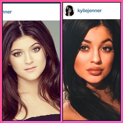 The Evolution Of Kylie Jenner: An Illustrated Timeline Of Her Changes