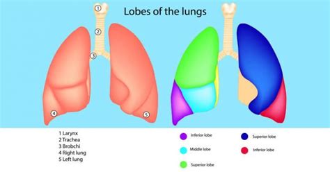 Robotic lobectomy Surgery for lung adenocarcinoma