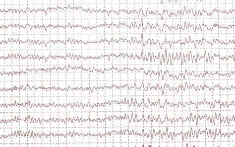 Brain waves electroencephalogramme (EEG) — Stock Photo © dusan964 #5407058