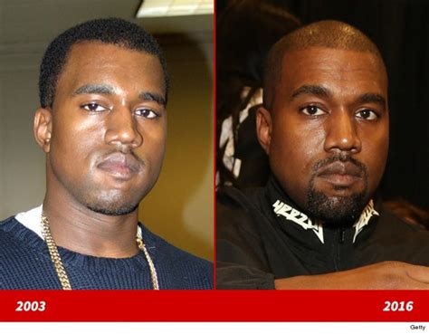 Kanye West Before Surgery