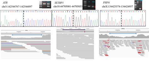 Sanger sequencing of structural variants. | Download Scientific Diagram