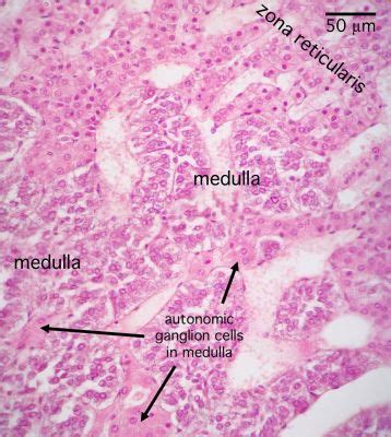 Adrenal Gland Histology - Adrenal medulla (labels) - histology slide