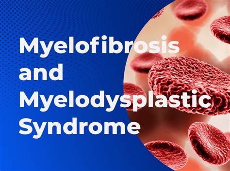 Myelofibrosis - Myelodysplastic Syndrome - Symptoms and Causes