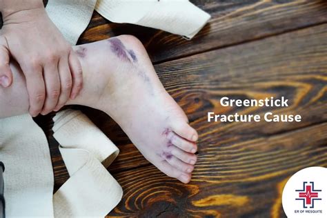 Greenstick Fracture: Causes, Symptoms, and Treatment | ER of Mesquite