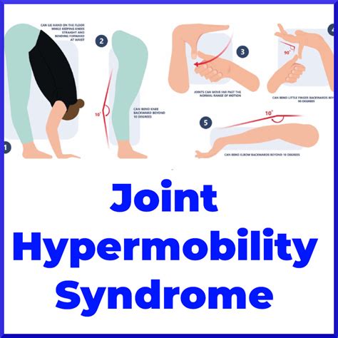 Understanding Hypermobile Ehlers-Danlos Syndrome EDS, 50% OFF