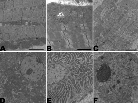 Mitochondria Electron Micrograph