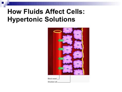 NurseReview.Org - Third Spacing: Where has all the fluids gone?