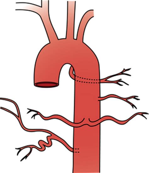 Pulmonary and bronchial arteries | Radiology Key