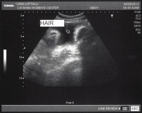 Ultrasound (30 weeks) – Philip, Leslie & Kayli