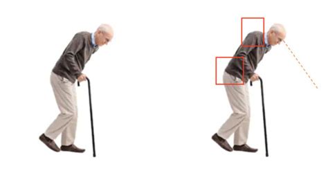 Senior Tips: Using a Cane Correctly