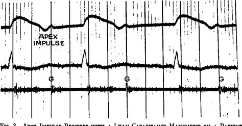 Figure 1 from Diastolic gallop sounds, the mechanism of production ...