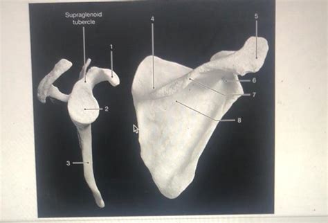 Solved Supraglenoid tubercle 3 Identify the structure | Chegg.com