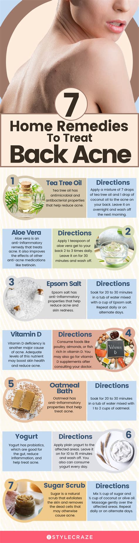 How To Get Rid Of Back Acne Using Home Remedies