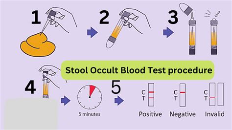 Stool occult blood test procedure step by step in lab