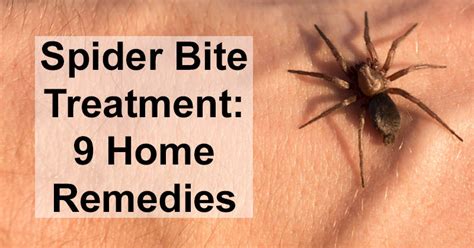 Spider Bite Treatment: 9 Home Remedies - DavidWolfe.com