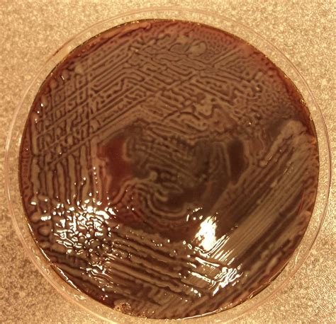 Identification Quantification Proteus Mirabilis Macconkey Agar Foto - Vrogue