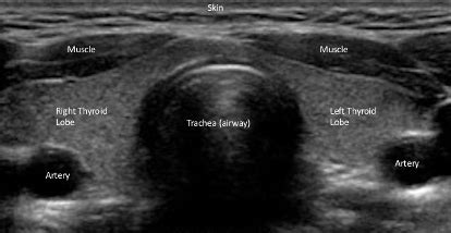 Ultrasound - Catherine Sinclair