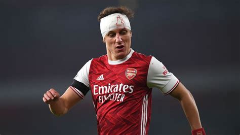 The extent of David Luiz head injury has been revealed - Just Arsenal News