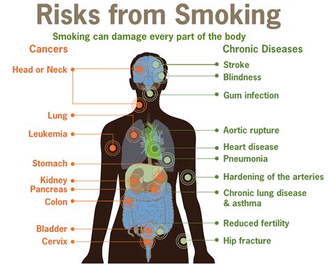 File:Risks form smoking-smoking can damage every part of the body.png - Wikimedia Commons