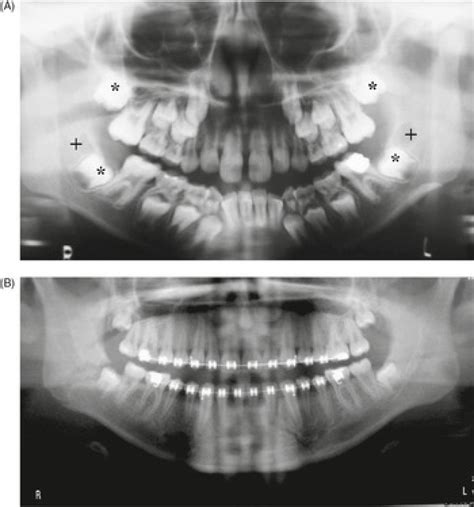 7 – Dental Devices | Radiology Key