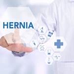 Do I Need Hernia Surgery?