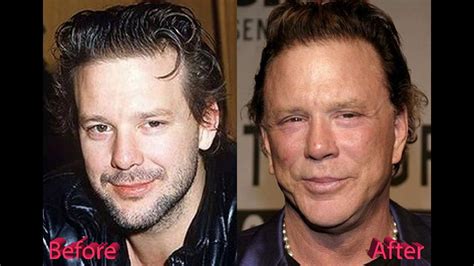 Mickey Rourke Plastic Surgery Before and After - YouTube