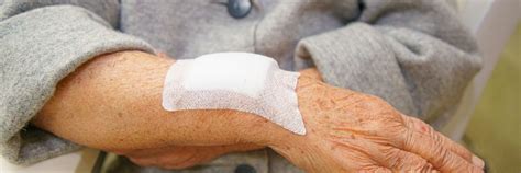 Understanding Elderly Skin Bruising | A Place for Mom