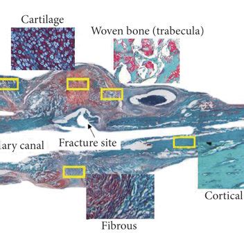 Comparison images of bone callus histology between the control and PEMF ...