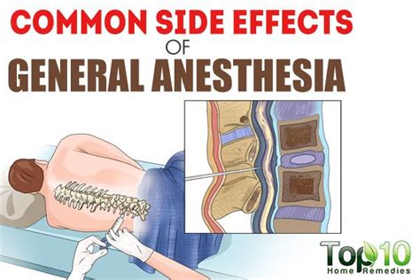 Side Effects of General Anesthesia You Must Know | Top 10 Home Remedies