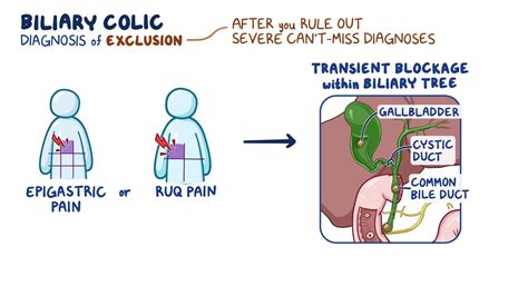 Approach to biliary colic: Clinical sciences - Osmosis Video Library