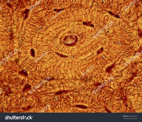 Light Micrograph Of An Osteon In Compact Bone Showing Osteocyte Lacunae And Numerous Radial ...