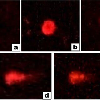 Comet assay visualization by epifluorescence microscopy. Comet tail... | Download Scientific Diagram