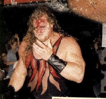 A shot (taken by a fan) of Kane's face after his first unmasking at Summerslam 2000 at the hands ...