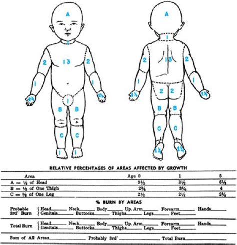 Burns- Children and Infants: Lund browder chart | Chart, Lund, Children