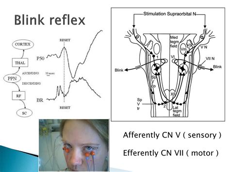 PPT - EEG brain for medical investigation and management PowerPoint ...