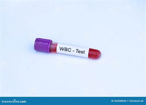 WBC Test To Look for Abnormalities from Blood Stock Photo - Image of doctor, patient: 264508058