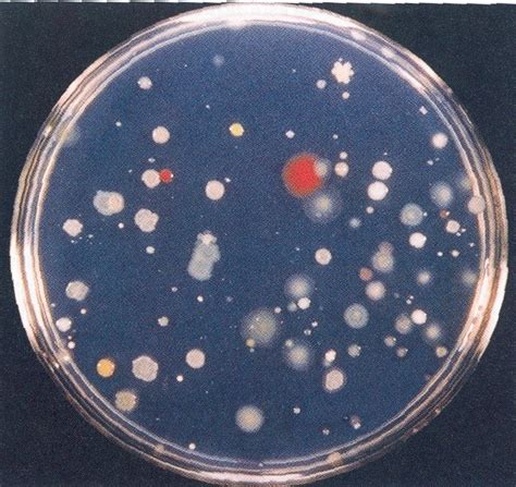 Soil Bacteria On Agar Plate