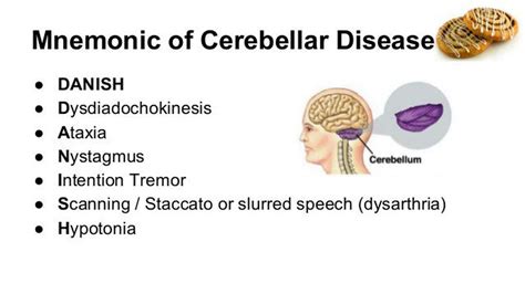 Signs and Symptoms of Cerebellar Lesion - MEDizzy