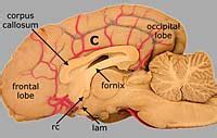 Lab 3 Brain Gross Anatomy - Telencephalon